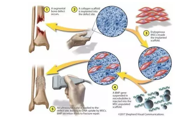 1531995185173742CUpI.png 18.png